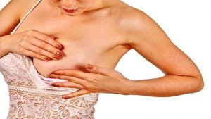 Memede Kıl Neden Olur? Kadınlarda Göğüs Kıllanması Nasıl Geçer? 