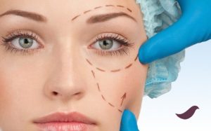 Gözaltı Dolgusu Nedir?