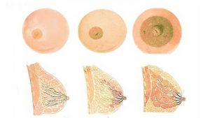 Memenin Kahverengi Kısmında Kabarcıklar Hamilelik Belirtisi Mi?