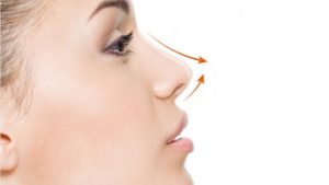 Burun Estetiği Nedir? Rinoplasti Aşamaları ve Fiyatları 