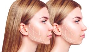 Yanak Yağları Nasıl Erir? 