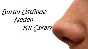 Burun Üstünde Neden Kıl Çıkar?