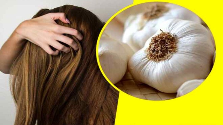 Sarımsağın Saça Faydaları Neler? 