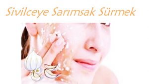 Sivilceye Sarımsak Sürmek Sivilceyi Geçirir Mi? 