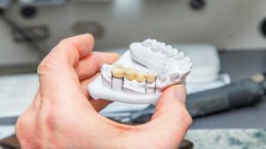 Dental Sentetik Alçı: Diş Hekimliğinde Yeni Nesil Bir Çözüm